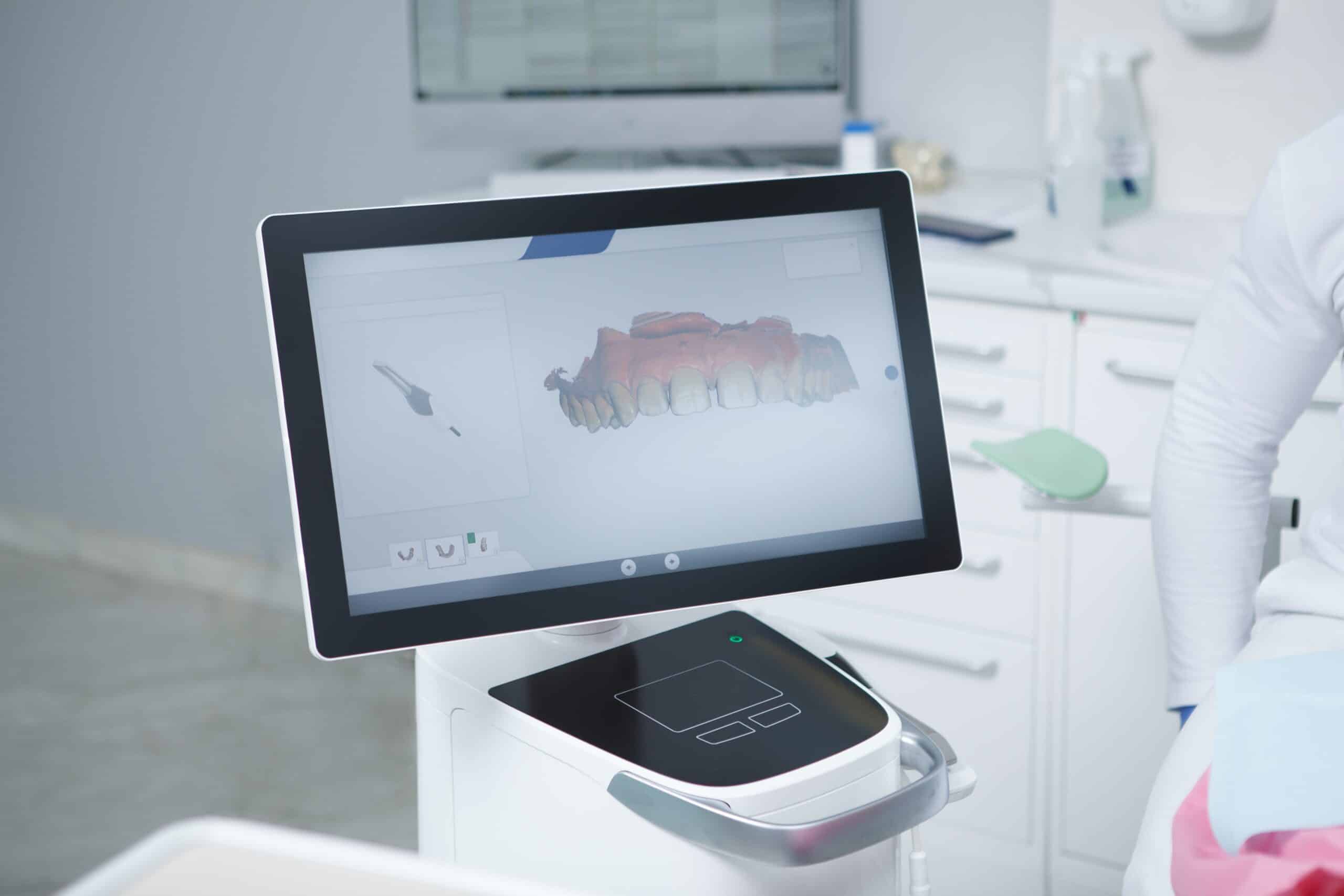 Dental,3d,Scan,On,Computer,Screen,At,Dentists,Office