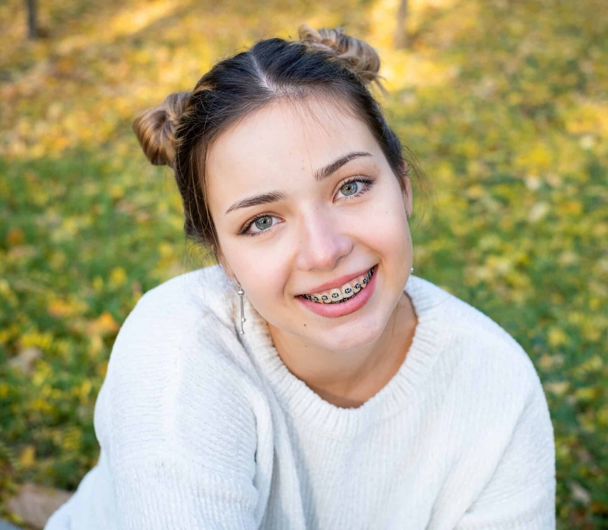 A,Teenage,Girl,With,Braces,Smiling.,Dentistry,For,Teenagers,,Red