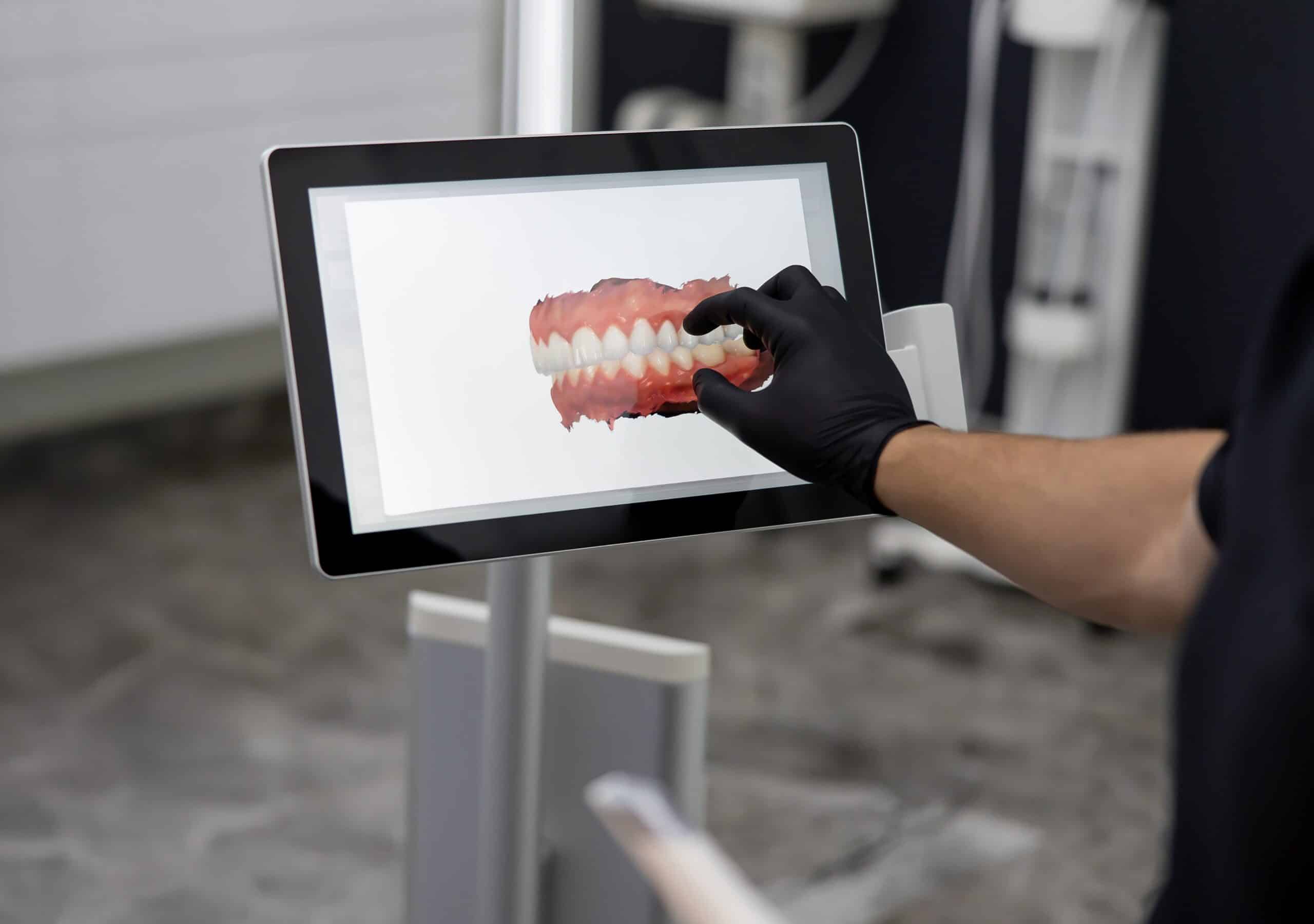 A,Doctor,Displays,A,3d,Dental,Scan,On,A,Monitor,